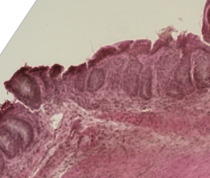 Mouse colon histology of acute graft versus host disease.png