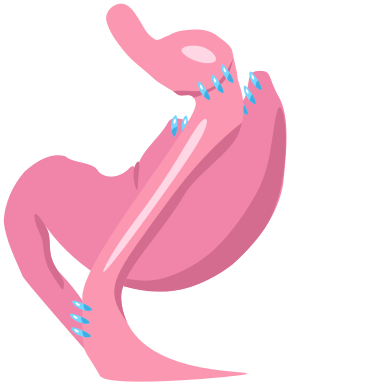 Gastric bypass icon.svg
