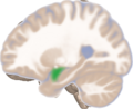 Left lateral view of the amygdala in an average human brain