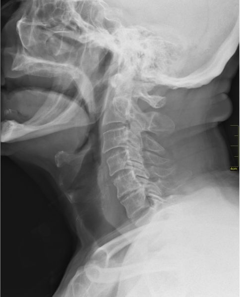 ملف:Medical X-Ray imaging EJE04 nevit.jpg