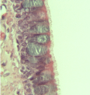 pseudostratified epithelium