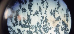 من عميلة التكاثر والتعديل الوراثي التي تتم على البعوض